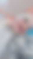 صورة العضو